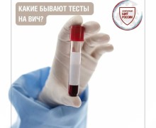 Тестирование на ВИЧ: как узнать свой статус