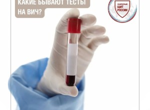 Тестирование на ВИЧ: как узнать свой статус